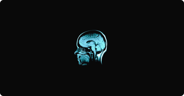 MRI scan of a human brain representing creative intelligence
