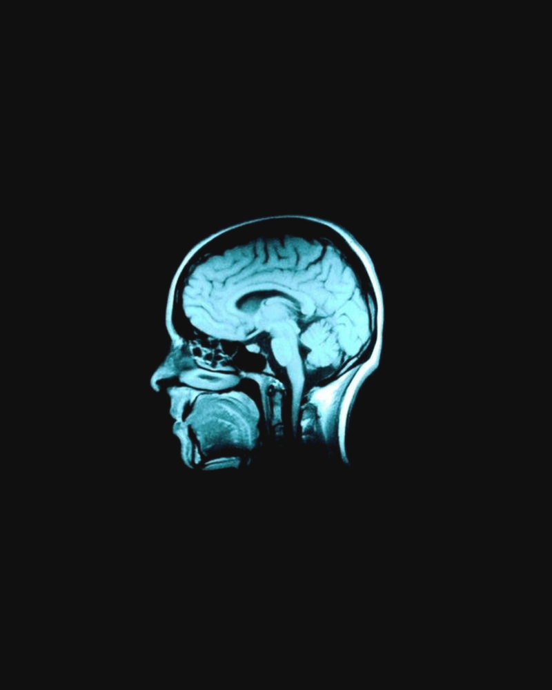 Creative intelligence in Bloom